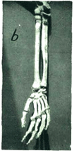 Figure 7b